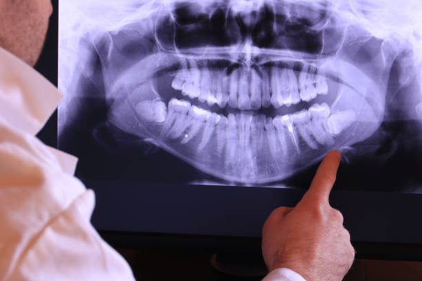 Best Emergency Denture Repair in Gardnerville, NV